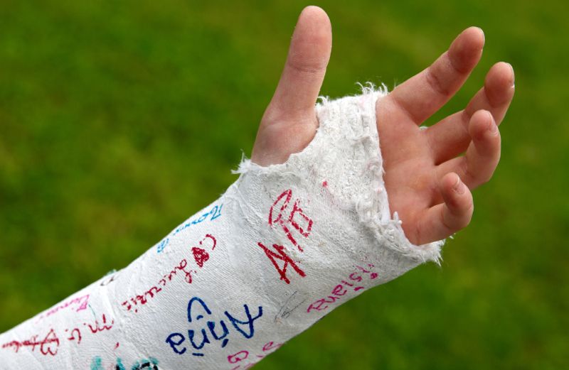 An arm in a cast covered with signatures