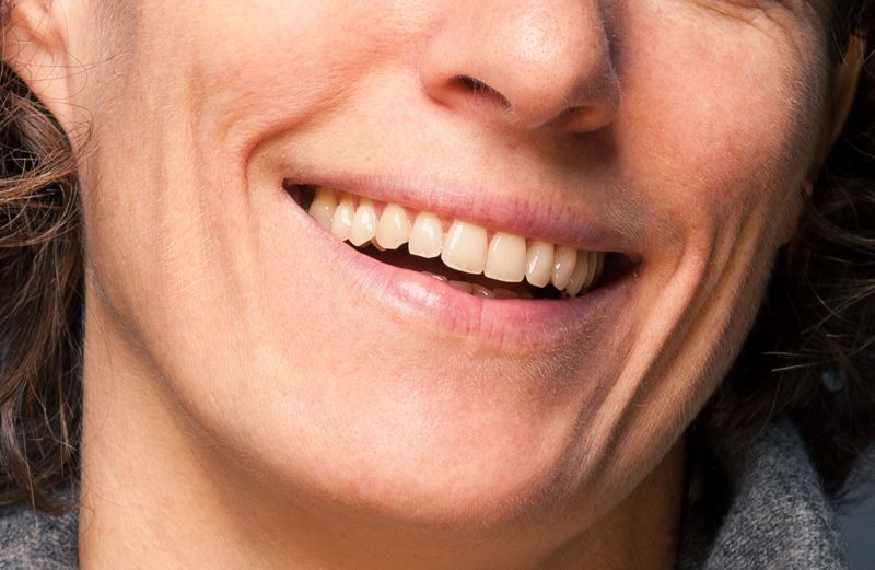 A close-up of a woman's smile