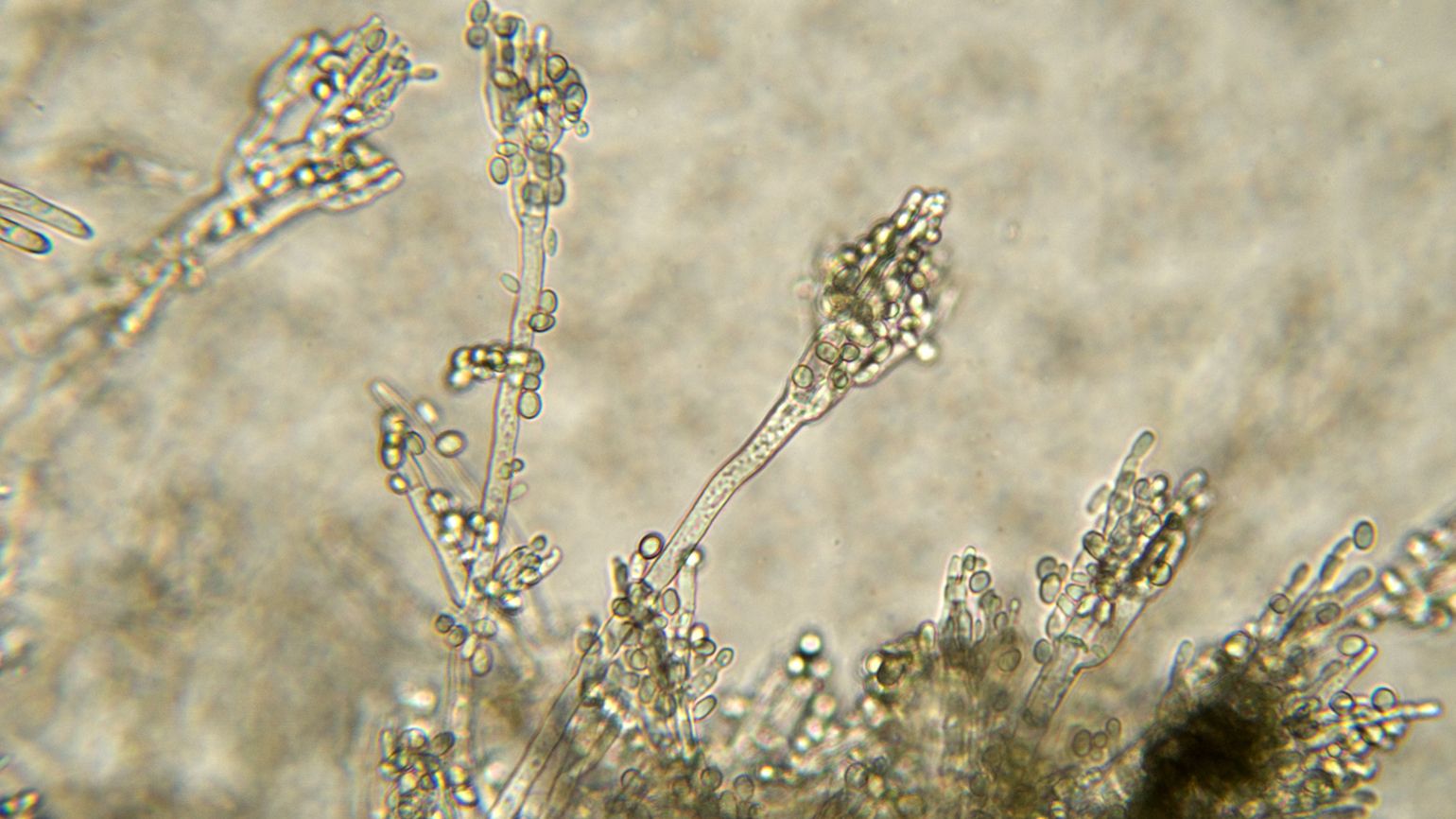 Microscopic close up of the penicillin bacteria.